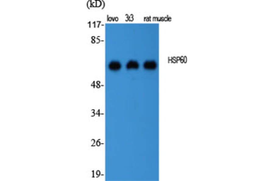 Western Blot - Anti-HSP60 Antibody (C0233) - Antibodies.com