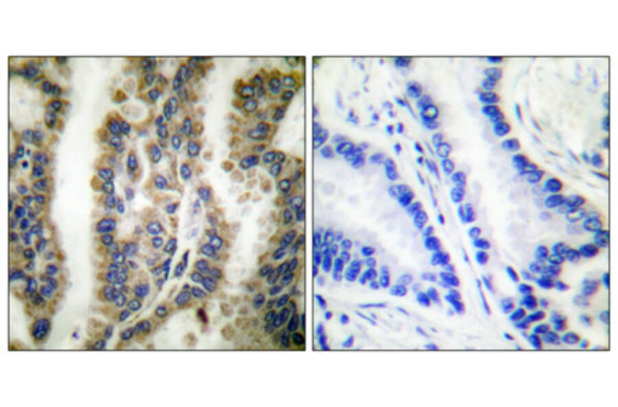 Immunohistochemistry - Anti-HSP60 Antibody (C0233) - Antibodies.com