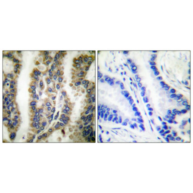 Immunohistochemistry - Anti-HSP60 Antibody (C0233) - Antibodies.com
