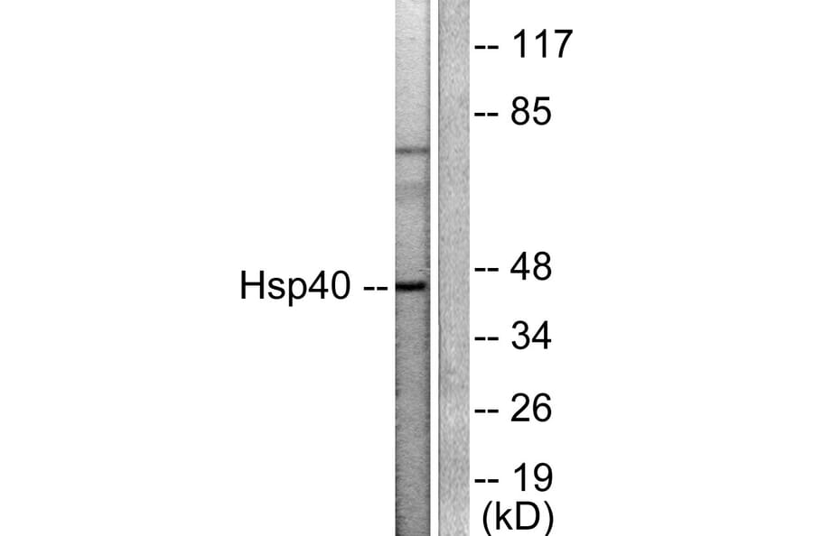 Western Blot - Anti-HSP40 Antibody (C0232) - Antibodies.com