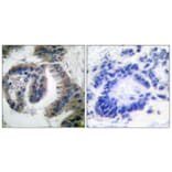 Immunohistochemistry - Anti-HSP40 Antibody (C0232) - Antibodies.com