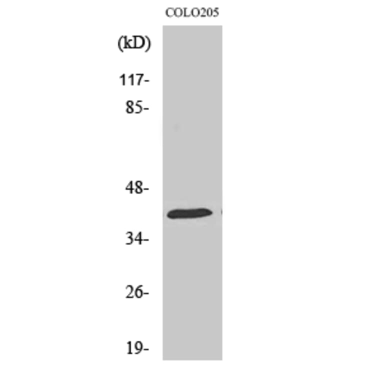 Western Blot - Anti-HSP40 Antibody (C0232) - Antibodies.com