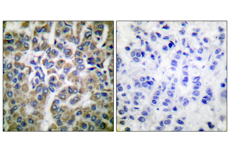 Immunohistochemistry - Anti-HSP10 Antibody (C0230) - Antibodies.com