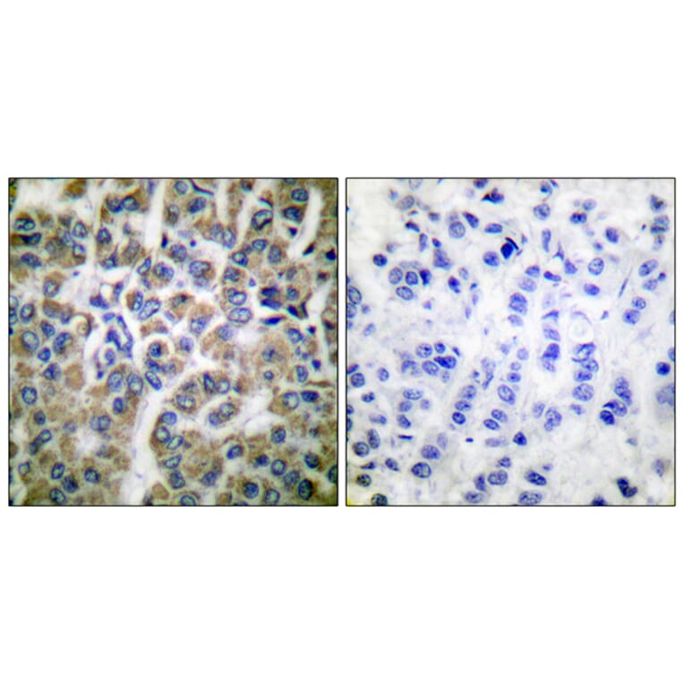 Immunohistochemistry - Anti-HSP10 Antibody (C0230) - Antibodies.com