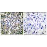 Immunohistochemistry - Anti-HSP10 Antibody (C0230) - Antibodies.com