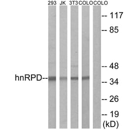 Western Blot - Anti-hnRPD Antibody (B1043) - Antibodies.com