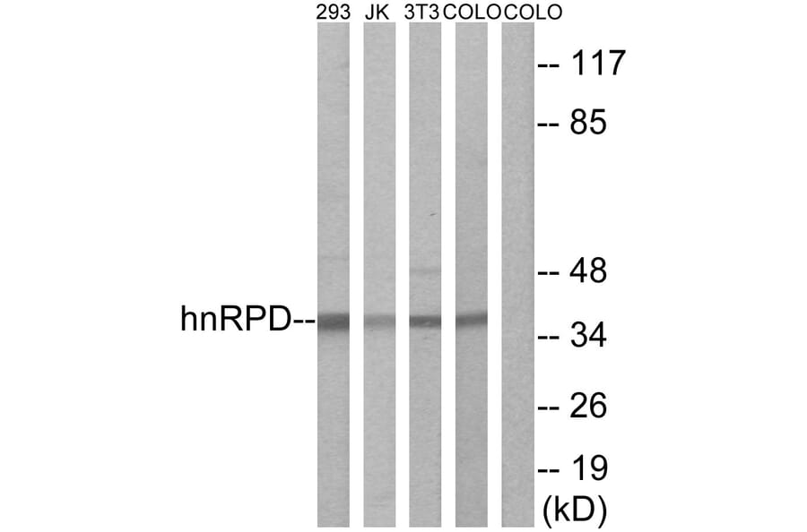 Western Blot - Anti-hnRPD Antibody (B1043) - Antibodies.com