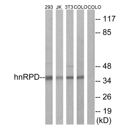 Western Blot - Anti-hnRPD Antibody (B1043) - Antibodies.com