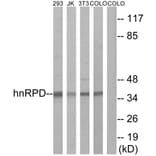 Western Blot - Anti-hnRPD Antibody (B1043) - Antibodies.com