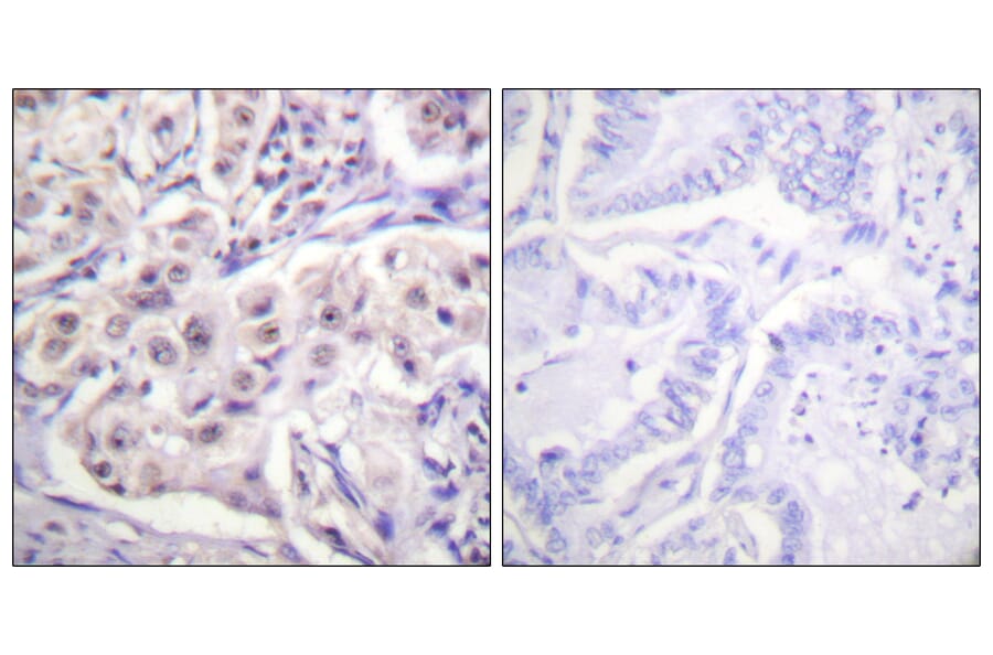 Immunohistochemistry - Anti-hnRPD Antibody (B1043) - Antibodies.com