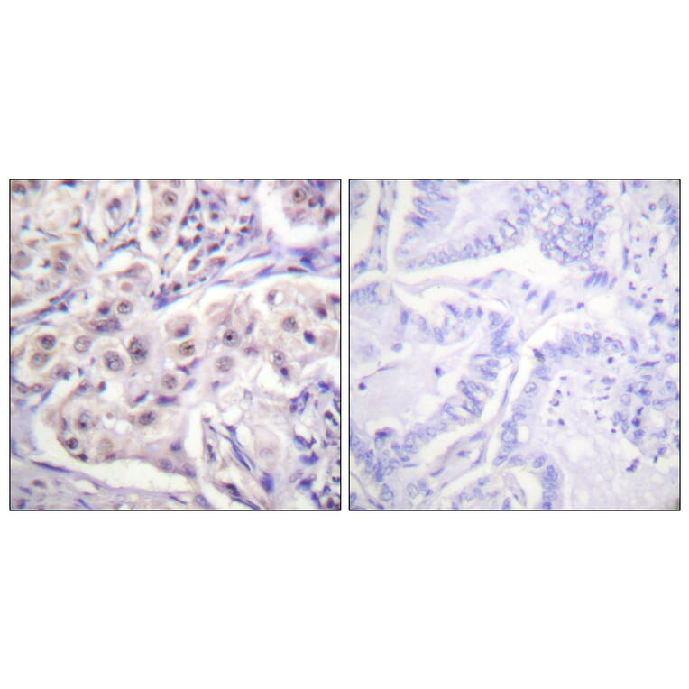 Immunohistochemistry - Anti-hnRPD Antibody (B1043) - Antibodies.com