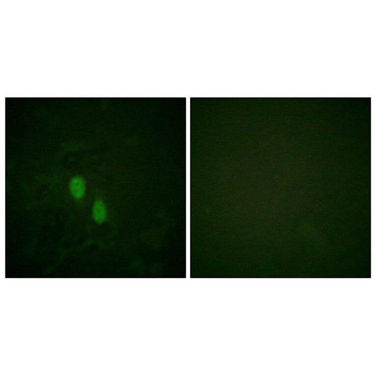 Immunofluorescence - Anti-hnRPD Antibody (B1043) - Antibodies.com