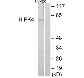 Western Blot - Anti-HIPK4 Antibody (C11365) - Antibodies.com