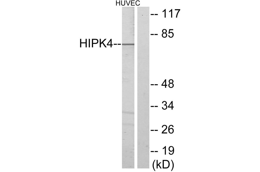 Western Blot - Anti-HIPK4 Antibody (C11365) - Antibodies.com