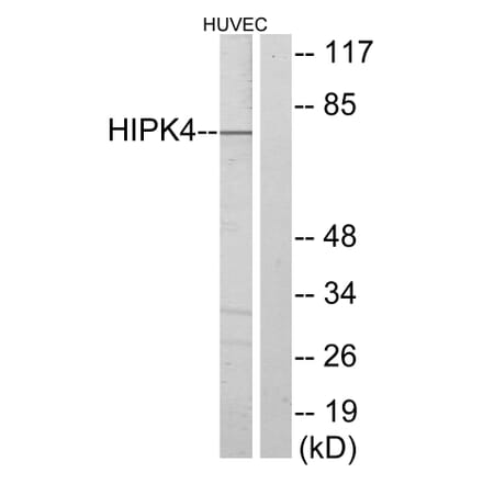 Western Blot - Anti-HIPK4 Antibody (C11365) - Antibodies.com