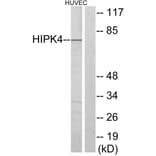 Western Blot - Anti-HIPK4 Antibody (C11365) - Antibodies.com