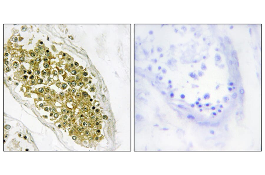 Immunohistochemistry - Anti-HIPK4 Antibody (C11365) - Antibodies.com