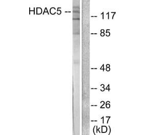 Western Blot - Anti-HDAC5 Antibody (C0225) - Antibodies.com