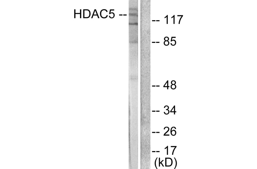 Western Blot - Anti-HDAC5 Antibody (C0225) - Antibodies.com