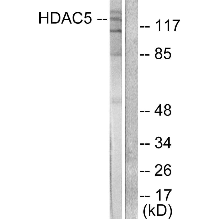 Western Blot - Anti-HDAC5 Antibody (C0225) - Antibodies.com