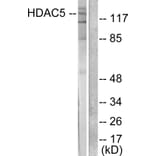 Western Blot - Anti-HDAC5 Antibody (C0225) - Antibodies.com