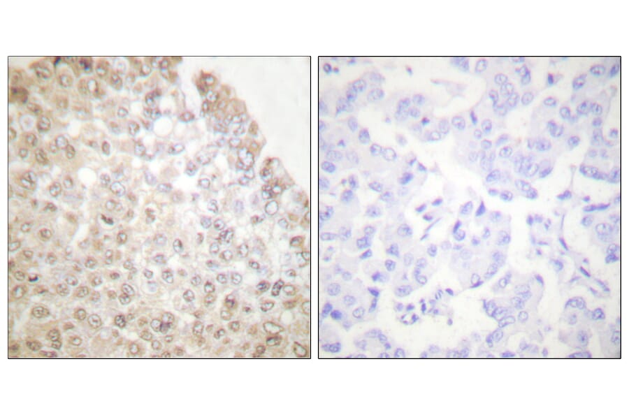 Immunohistochemistry - Anti-HDAC5 Antibody (C0225) - Antibodies.com
