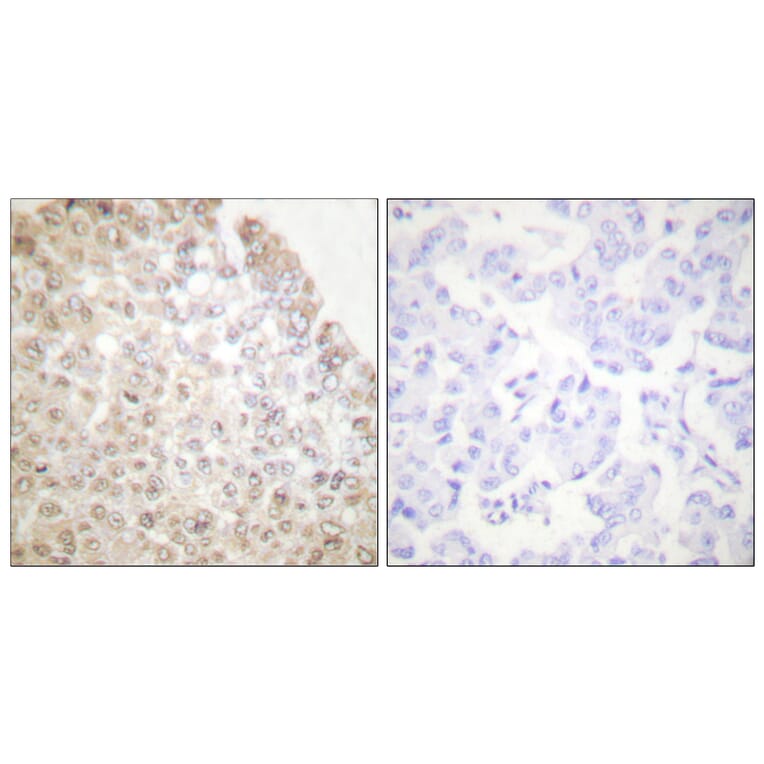 Immunohistochemistry - Anti-HDAC5 Antibody (C0225) - Antibodies.com