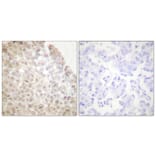 Immunohistochemistry - Anti-HDAC5 Antibody (C0225) - Antibodies.com