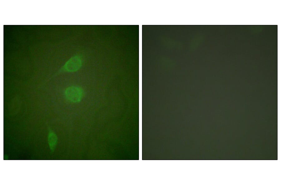 Immunofluorescence - Anti-HDAC5 Antibody (C0225) - Antibodies.com