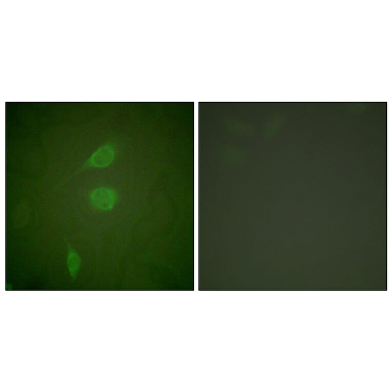 Immunofluorescence - Anti-HDAC5 Antibody (C0225) - Antibodies.com