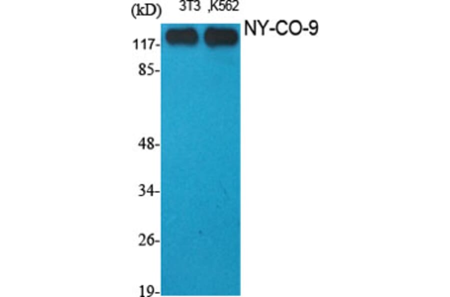 Western Blot - Anti-HDAC5 Antibody (C0225) - Antibodies.com