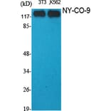 Western Blot - Anti-HDAC5 Antibody (C0225) - Antibodies.com