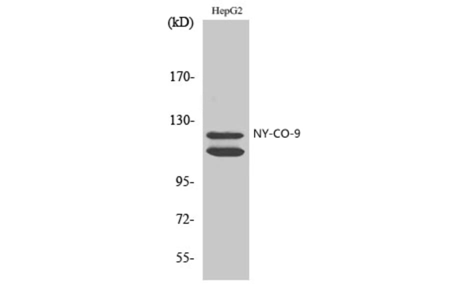 Western Blot - Anti-HDAC5 Antibody (C0225) - Antibodies.com