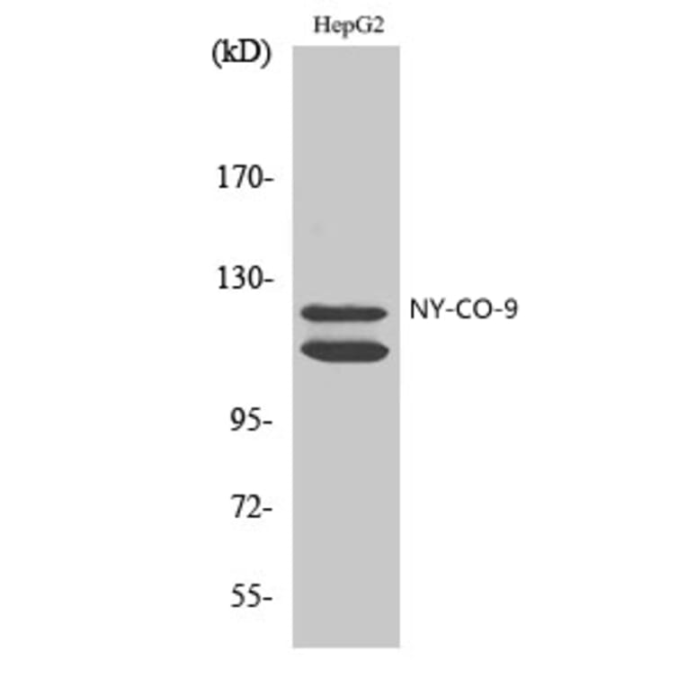 Western Blot - Anti-HDAC5 Antibody (C0225) - Antibodies.com