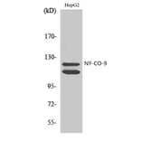 Western Blot - Anti-HDAC5 Antibody (C0225) - Antibodies.com