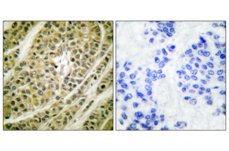 Immunohistochemistry - Anti-HDAC5 Antibody (C0225) - Antibodies.com
