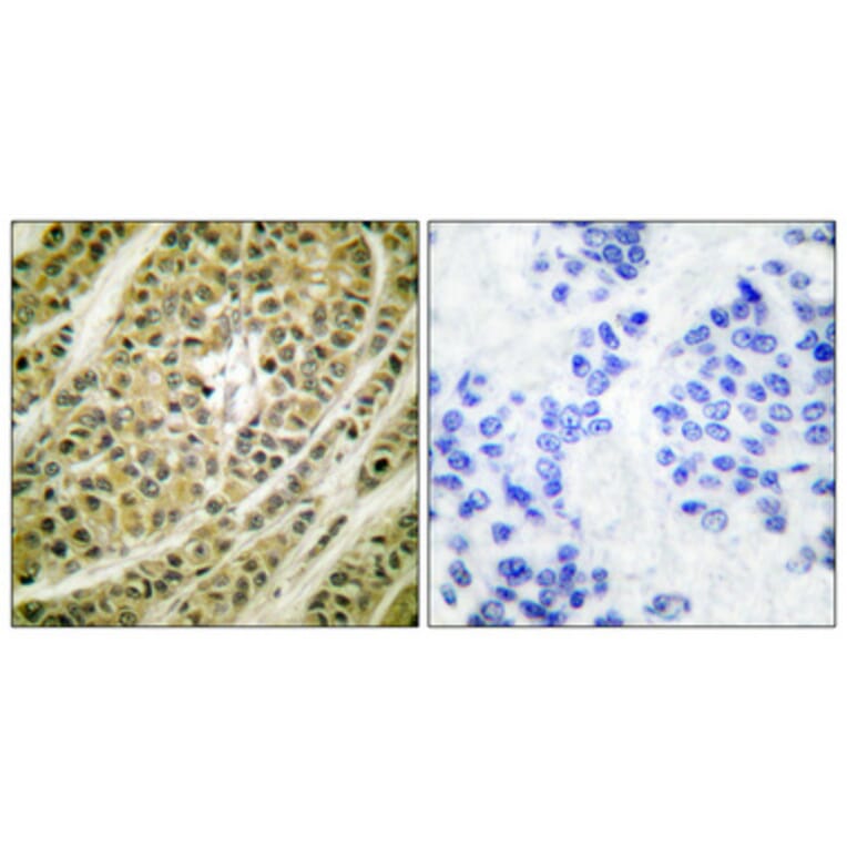 Immunohistochemistry - Anti-HDAC5 Antibody (C0225) - Antibodies.com