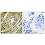 Immunohistochemistry - Anti-HDAC5 Antibody (C0225) - Antibodies.com