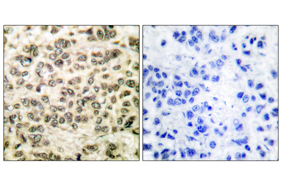 Immunohistochemistry - Anti-HDAC3 Antibody (C0224) - Antibodies.com