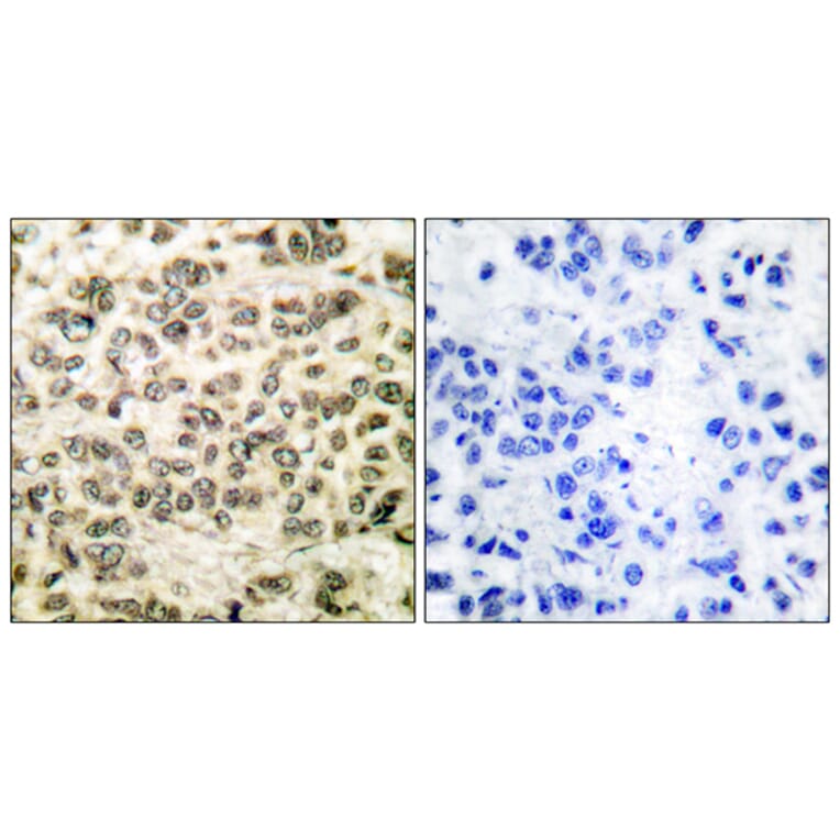Immunohistochemistry - Anti-HDAC3 Antibody (C0224) - Antibodies.com