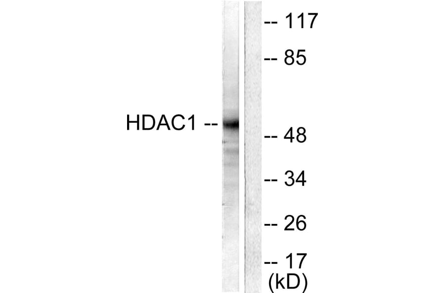 Western Blot - Anti-HDAC1 Antibody (C0221) - Antibodies.com