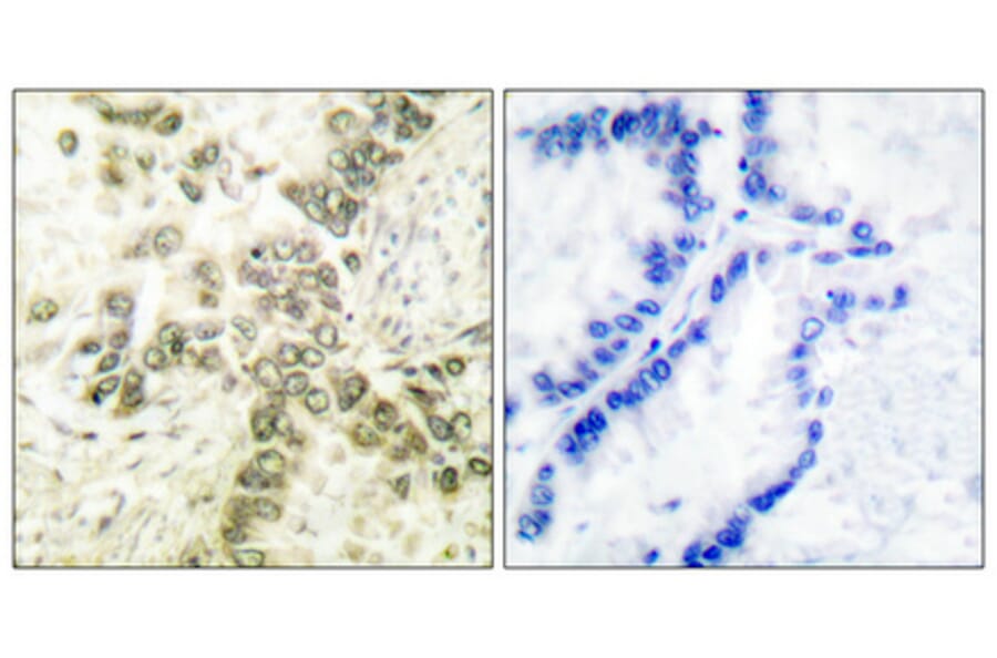 Immunohistochemistry - Anti-HDAC1 Antibody (C0221) - Antibodies.com
