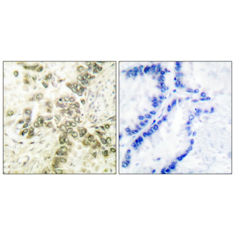 Immunohistochemistry - Anti-HDAC1 Antibody (C0221) - Antibodies.com