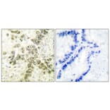 Immunohistochemistry - Anti-HDAC1 Antibody (C0221) - Antibodies.com