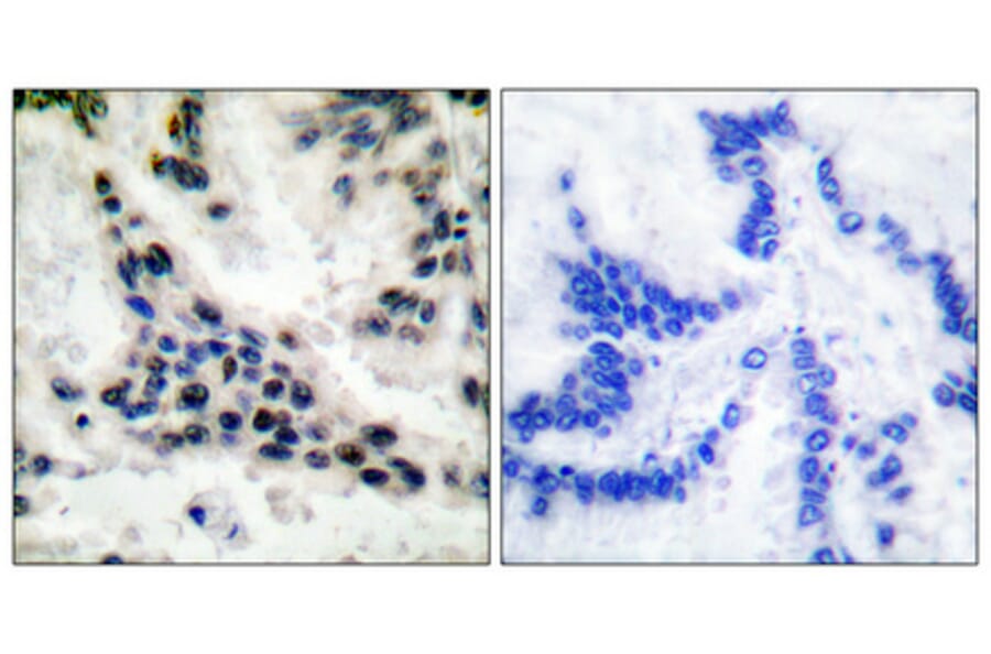 Immunohistochemistry - Anti-HDAC1 Antibody (C0221) - Antibodies.com