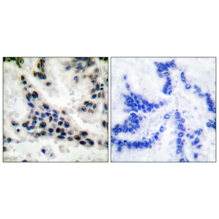 Immunohistochemistry - Anti-HDAC1 Antibody (C0221) - Antibodies.com