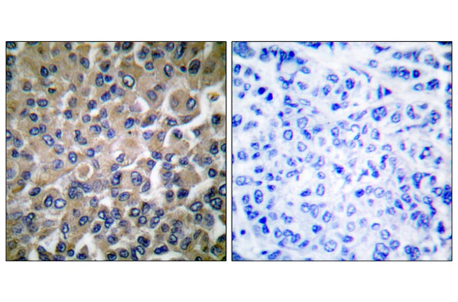 Immunohistochemistry - Anti-GRP78 Antibody (C0217) - Antibodies.com