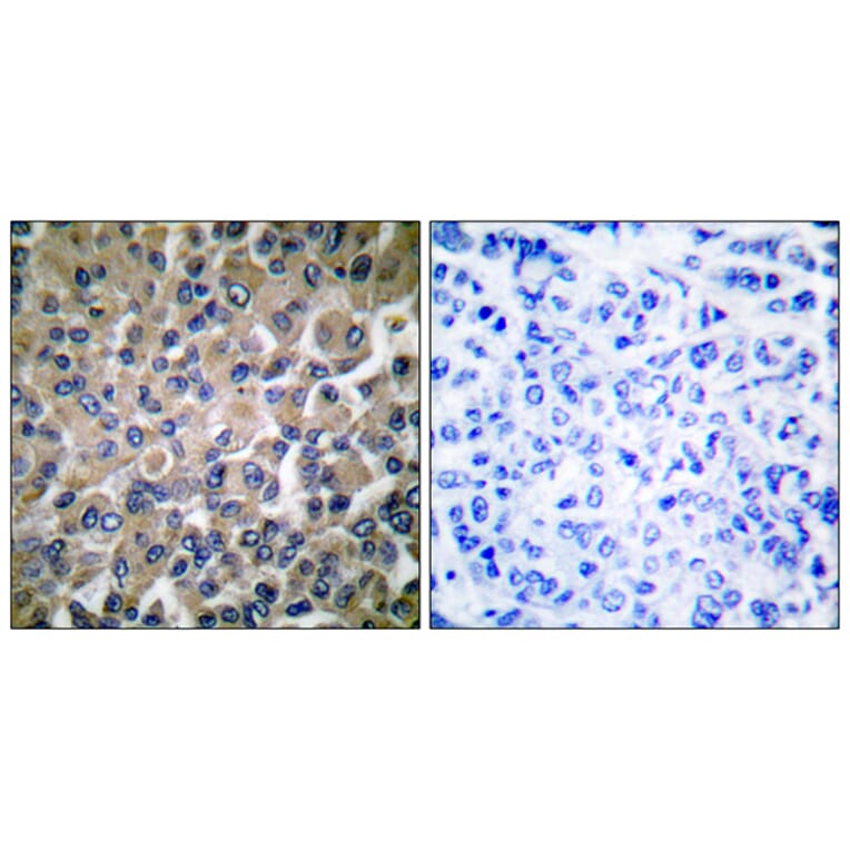 Immunohistochemistry - Anti-GRP78 Antibody (C0217) - Antibodies.com