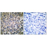 Immunohistochemistry - Anti-GRP78 Antibody (C0217) - Antibodies.com