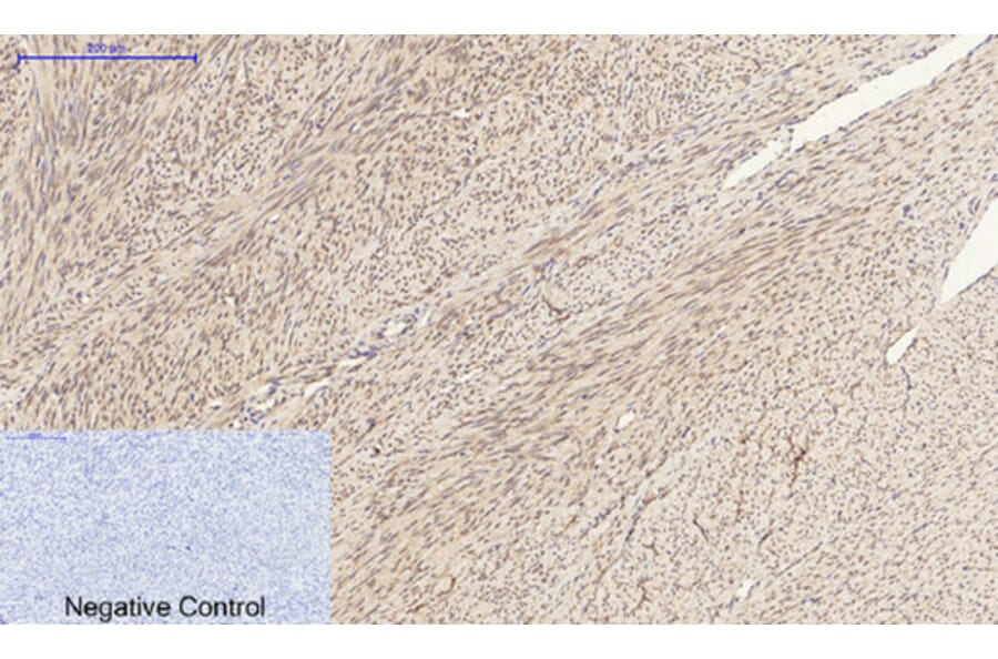 Immunohistochemistry - Anti-GRP78 Antibody (C0217) - Antibodies.com